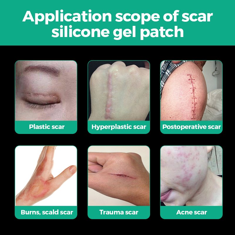 Cerotti e nastro in gel di silicone al collagene per le cicatrici - 11
